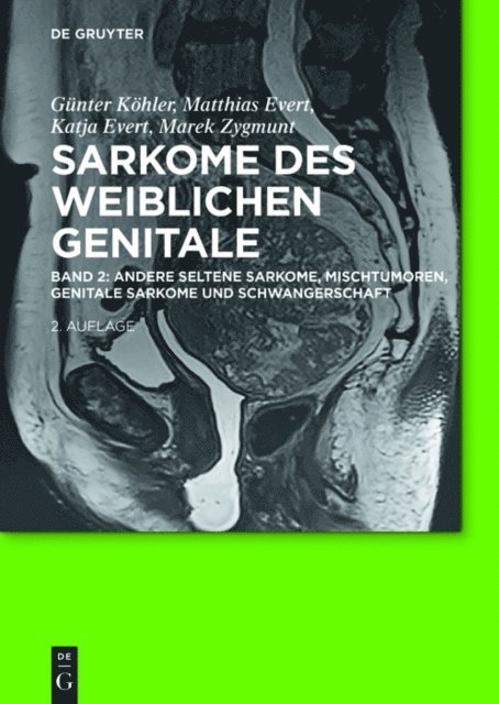 Marek Zygmunt, Katja Evert, Matthias Evert, Gunter Kohler - Andere seltene Sarkome, Mischtumoren, genitale Sarkome und Schwangerschaft, E-bok
