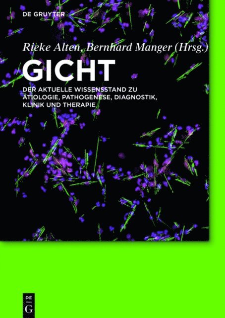 Bernhard Manger, Rieke Alten - Gicht, E-bok. Tillgänglighet: Lägg i varukorg