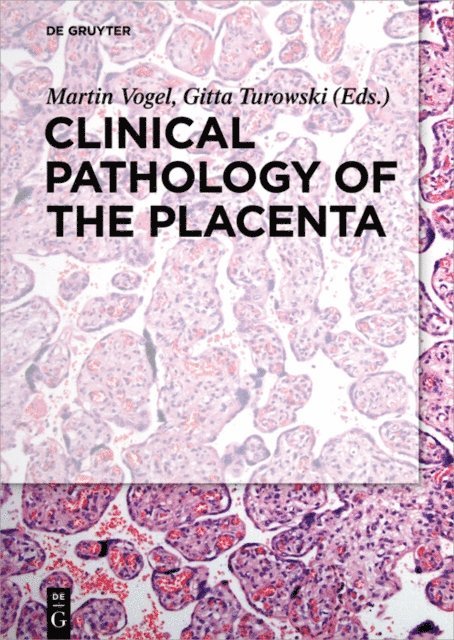 Gitta Turowski, Martin Vogel - Clinical Pathology of the Placenta, E-bok