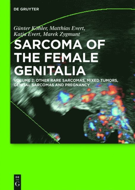Marek Zygmunt, Katja Evert, Matthias Evert, Gunter Kohler - Other Rare Sarcomas, Mixed Tumors, Genital Sarcomas and Pregnancy, E-bok
