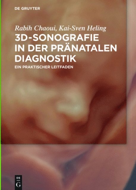 Kai-Sven Heling, Rabih Chaoui - 3D-Sonografie in der pränatalen Diagnostik, E-bok