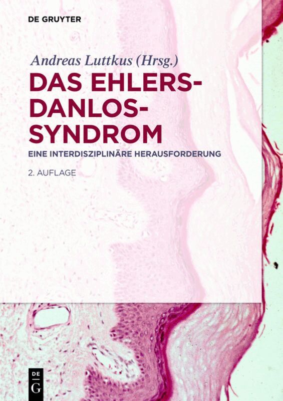 Andreas Luttkus - Ehlers-Danlos-Syndrom, Inbunden. Tillgänglighet: Lägg i varukorg