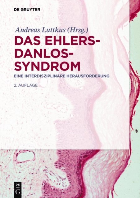 Andreas Luttkus - Das Ehlers-Danlos-Syndrom, E-bok. Tillgänglighet: Lägg i varukorg
