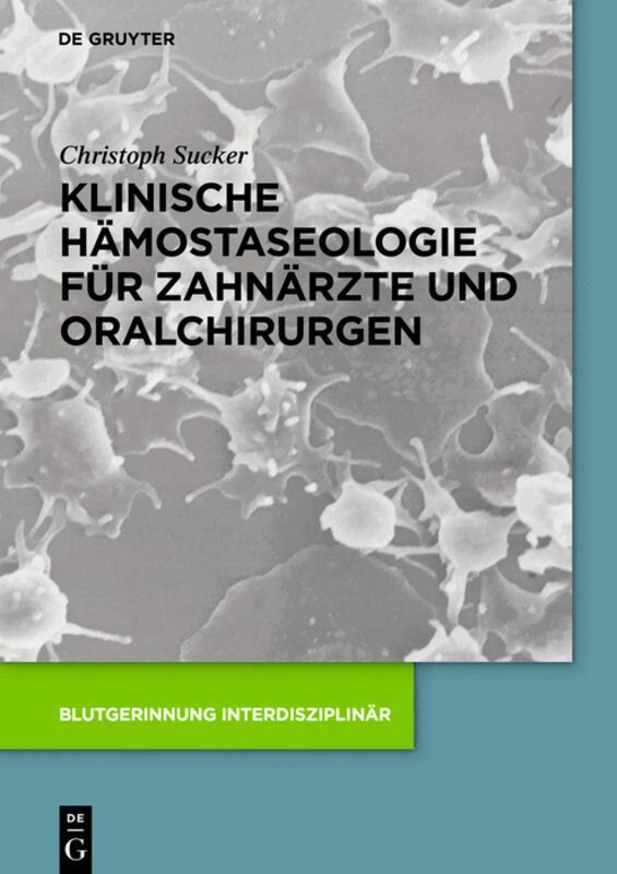 Christoph Sucker - Klinische Hämostaseologie für Zahnärzte und Oralchirurgen, Inbunden. Tillgänglighet: Lägg i varukorg