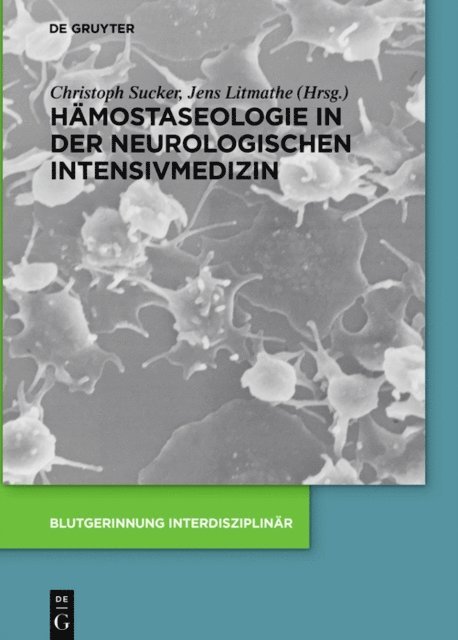 Jens Litmathe, Christoph Sucker - Hämostaseologie in der neurologischen Intensivmedizin, E-bok. Tillgänglighet: Lägg i varukorg