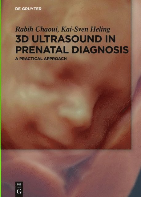 Kai-Sven Heling, Rabih Chaoui - 3D Ultrasound in Prenatal Diagnosis, E-bok