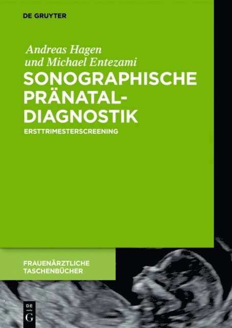 Michael Entezami, Andreas Hagen - Sonographische Pränataldiagnostik, E-bok