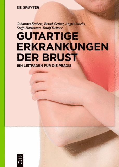 Toralf Reimer, Steffi Hartmann, Angrit Stachs, Bernd Gerber, Johannes Stubert - Gutartige Erkrankungen der Brust, E-bok