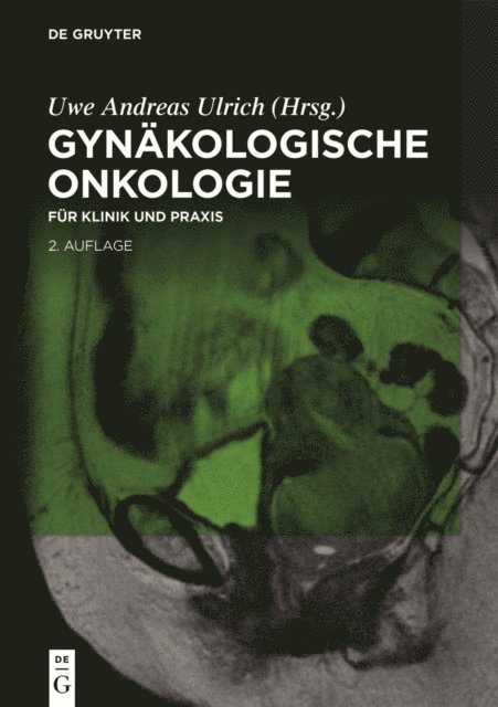 Uwe Andreas Ulrich - Gynäkologische Onkologie, E-bok