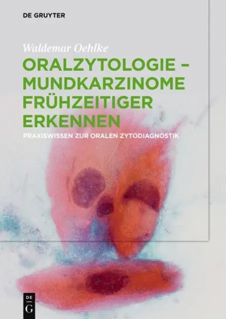 Waldemar Oehlke - Oralzytologie - Mundkarzinome frühzeitiger erkennen, E-bok. Tillgänglighet: Lägg i varukorg