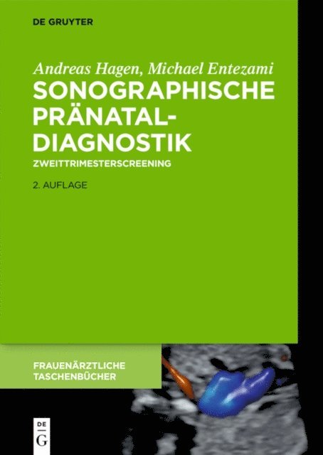 Andreas Hagen, Michael Entezami - Sonographische Pränataldiagnostik, E-bok