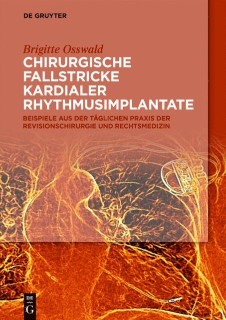 Brigitte Osswald - Chirurgische Fallstricke kardialer Rhythmusimplantate, E-bok