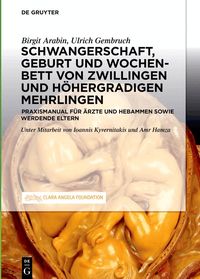 Schwangerschaft, Geburt und Wochenbett von Zwillingen und h�hergradigen Mehrlingen