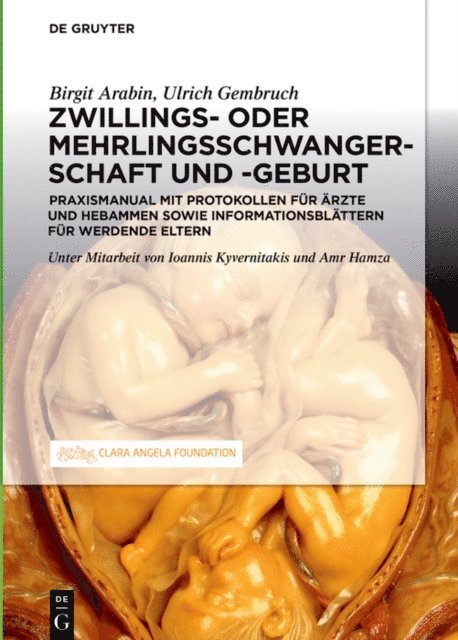 Ulrich Gembruch, Birgit Arabin - Schwangerschaft, Geburt und Wochenbett von Zwillingen und höhergradigen Mehrlingen, E-bok