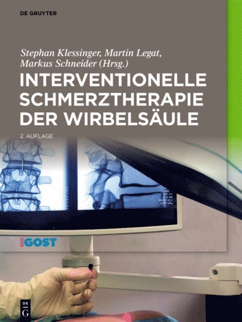 Markus Schneider, Martin Legat, Stephan Klessinger - Interventionelle Schmerztherapie der Wirbelsäule, E-bok