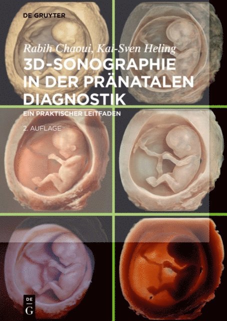 Kai-Sven Heling, Rabih Chaoui - 3D-Sonographie in der pränatalen Diagnostik, E-bok