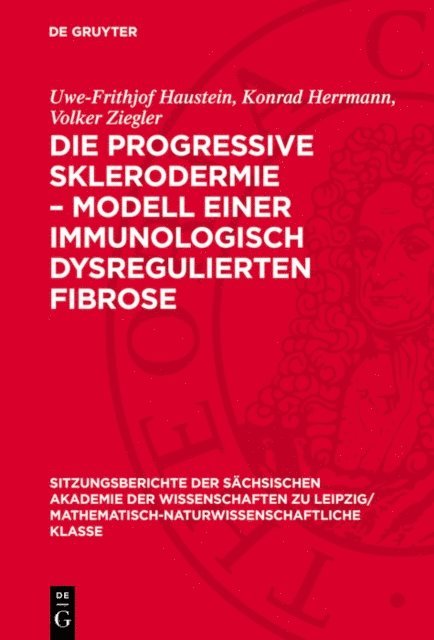 Volker Ziegler, Konrad Herrmann, Uwe-Frithjof Haustein - Die progressive Sklerodermie – Modell einer immunologisch dysregulierten Fibrose, E-bok