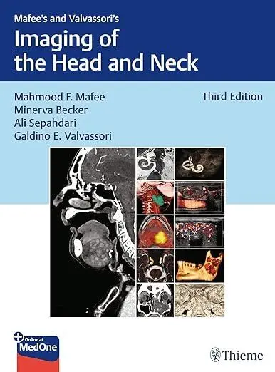 Mahmood F. Mafee, Minerva Becker, Ali R. Sepahdari, Galdino E. Valvassori - Mafee's and Valvassori's Imaging of the Head and Neck. Tillgänglighet: Kommande