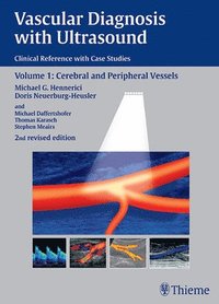 Vascular Diagnosis with Ultrasound