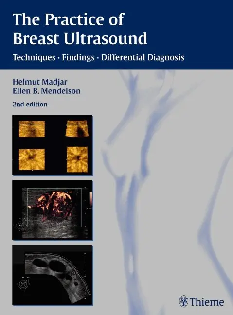 Helmut Madjar, Ellen B. Mendelson - Practice of Breast Ultrasound, Inbunden. Tillgänglighet: Tillfälligt slut