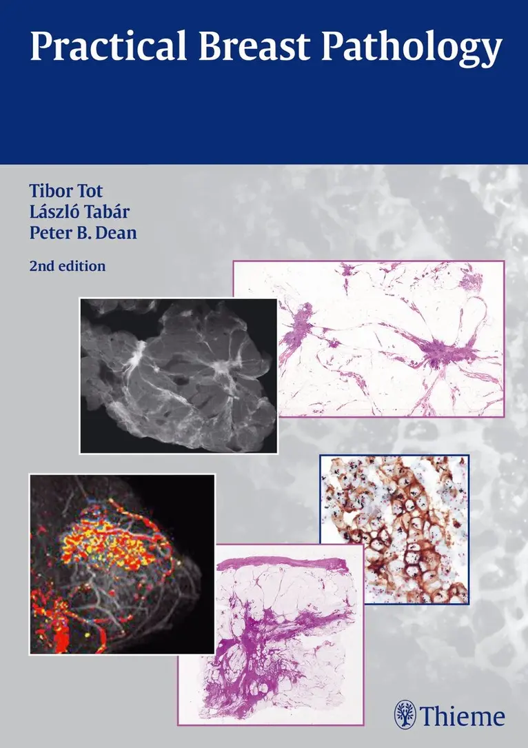 Tibor Tot, Laszlo Tabar, Peter B. Dean - Practical Breast Pathology, Inbunden. Tillgänglighet: Lägg i varukorg