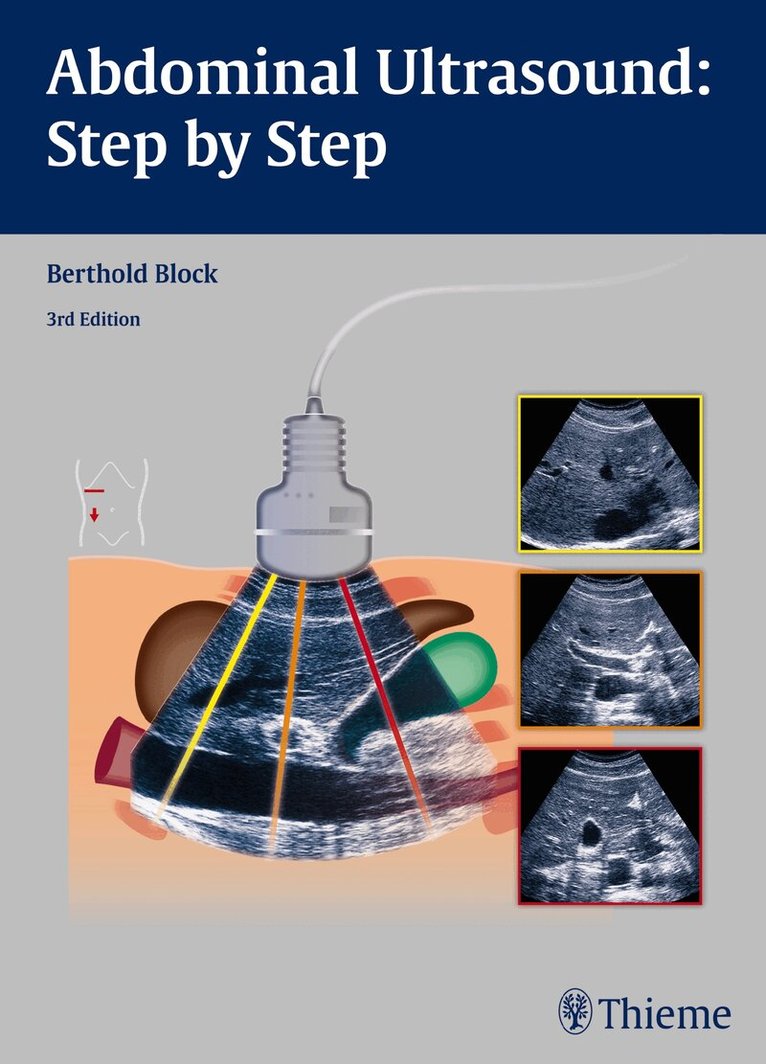 Berthold Block - Abdominal Ultrasound: Step by Step, Häftad