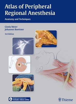 Atlas of Peripheral Regional Anesthesia av Gisela Meier, Johannes Buettner