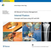 AO Manual of Fracture Management: Internal Fixators