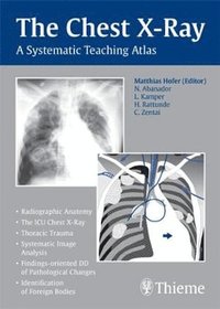 Chest X-Ray