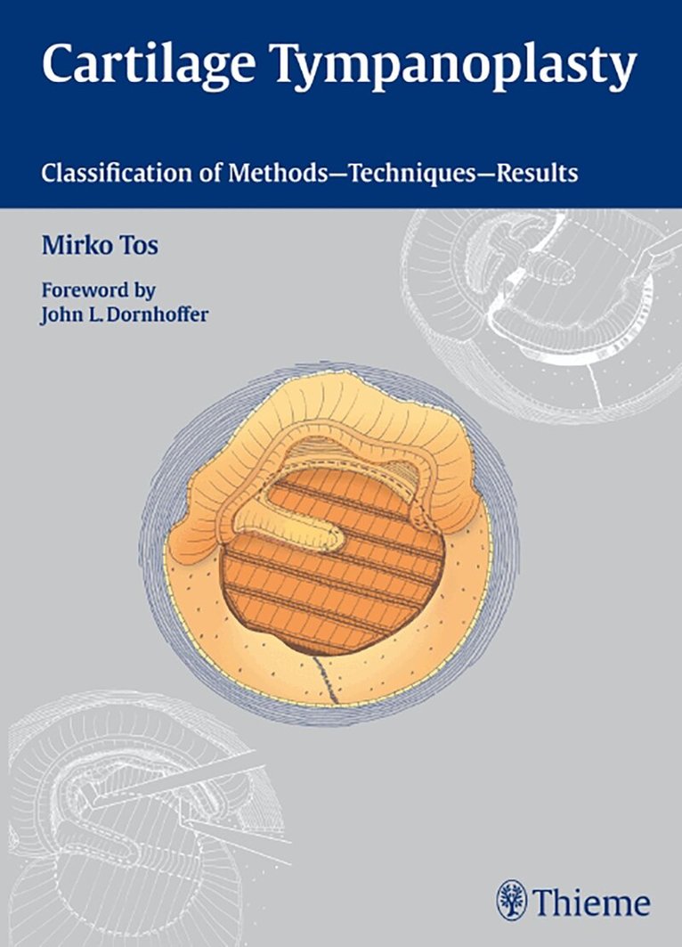 Mirko Tos - Cartilage Tympanoplasty, Inbunden. Tillgänglighet: Lägg i varukorg