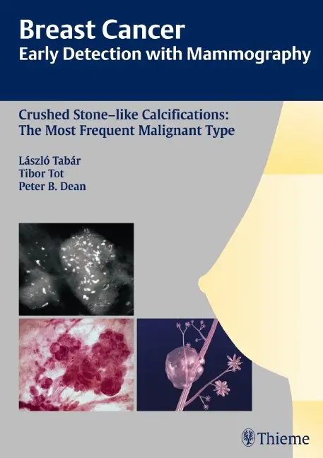 Laszlo Tabar, Tibor Tot, Peter B. Dean - Breast Cancer: Early Detection with Mammography, Inbunden. Tillgänglighet: Lägg i varukorg