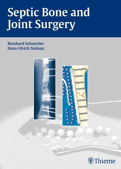 Reinhard Schnettler, Hans-Ulrich Steinau - Septic Bone and Joint Surgery, Inbunden. Tillgänglighet: Lägg i varukorg