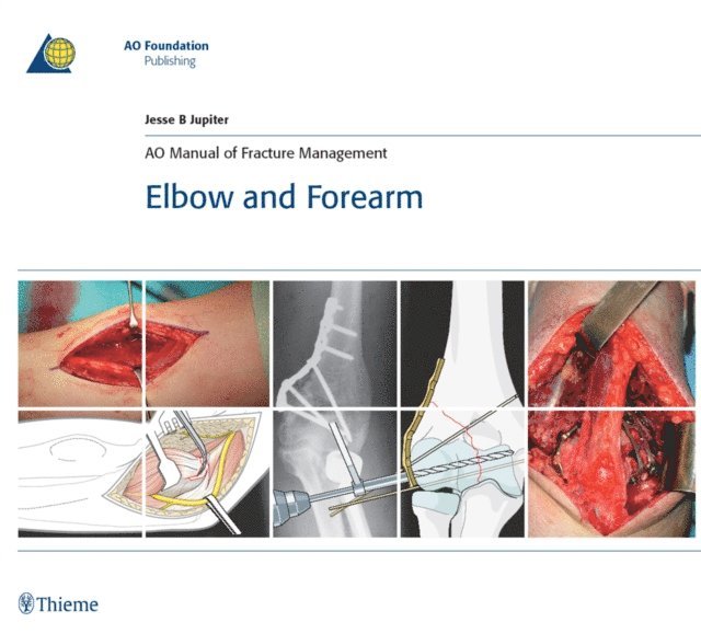 Jesse Jupiter - AO Manual of Fracture Management - Elbow and Forearm, E-bok