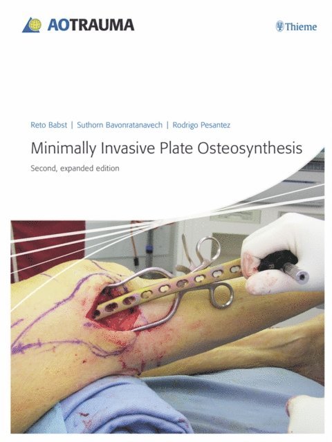 Rodrigo F. Pesantez, Suthorn Bavonratanavech, Reto Babst - Minimally Invasive Plate Osteosynthesis (MIPO), E-bok