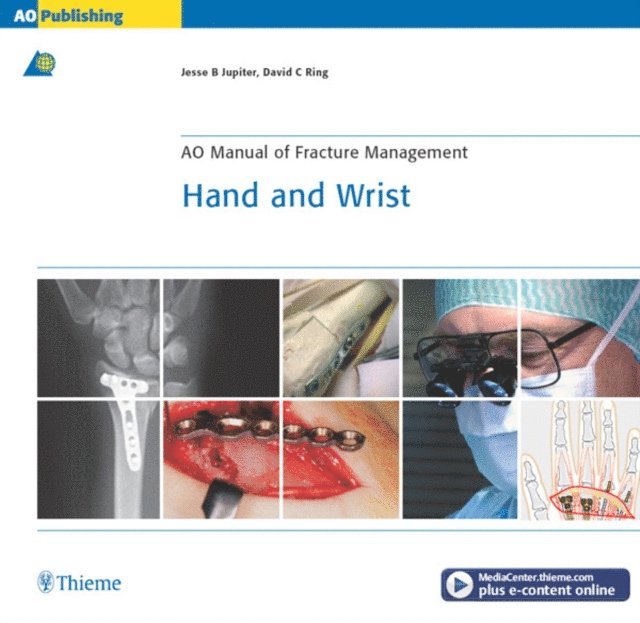 David C. Ring, Jesse Jupiter - AO Manual of Fracture Management - Hand and Wrist, E-bok