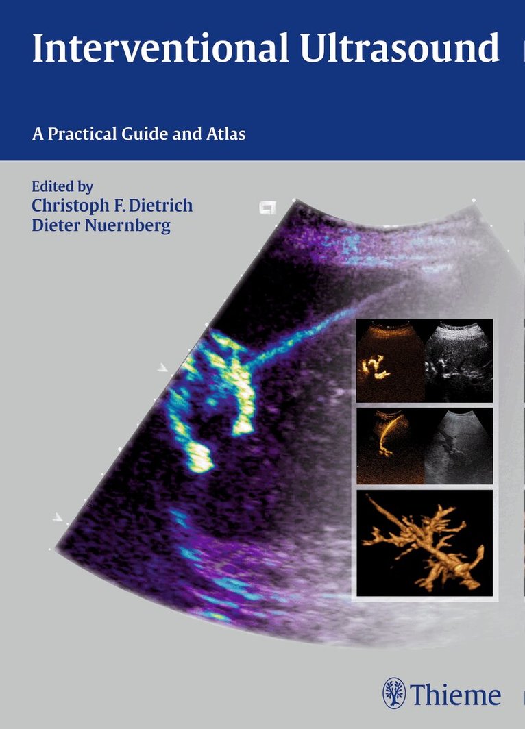 Christoph Frank Dietrich, Dieter Nürnberg - Interventional Ultrasound, Inbunden. Tillgänglighet: Tillfälligt slut
