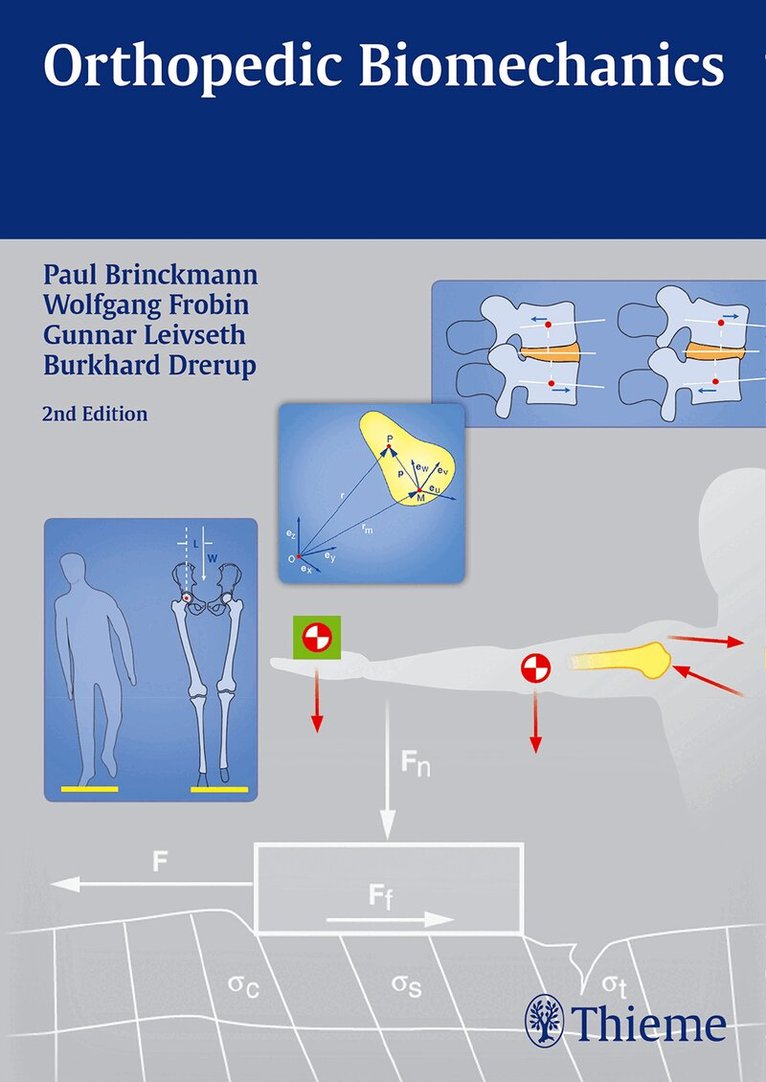 Paul Brinckmann, Wolfgang Frobin, Gunnar Leivseth, Burkhard Drerup - Orthopedic Biomechanics, Häftad. Tillgänglighet: Lägg i varukorg