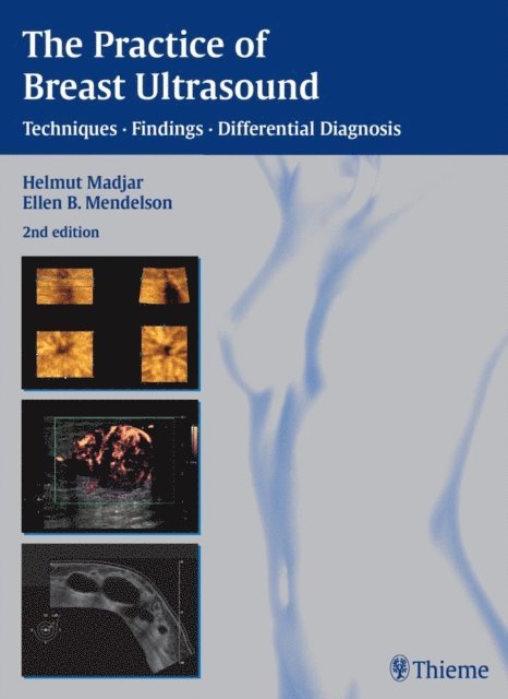 Ellen B. Mendelson, Helmut Madjar - Practice of Breast Ultrasound, E-bok