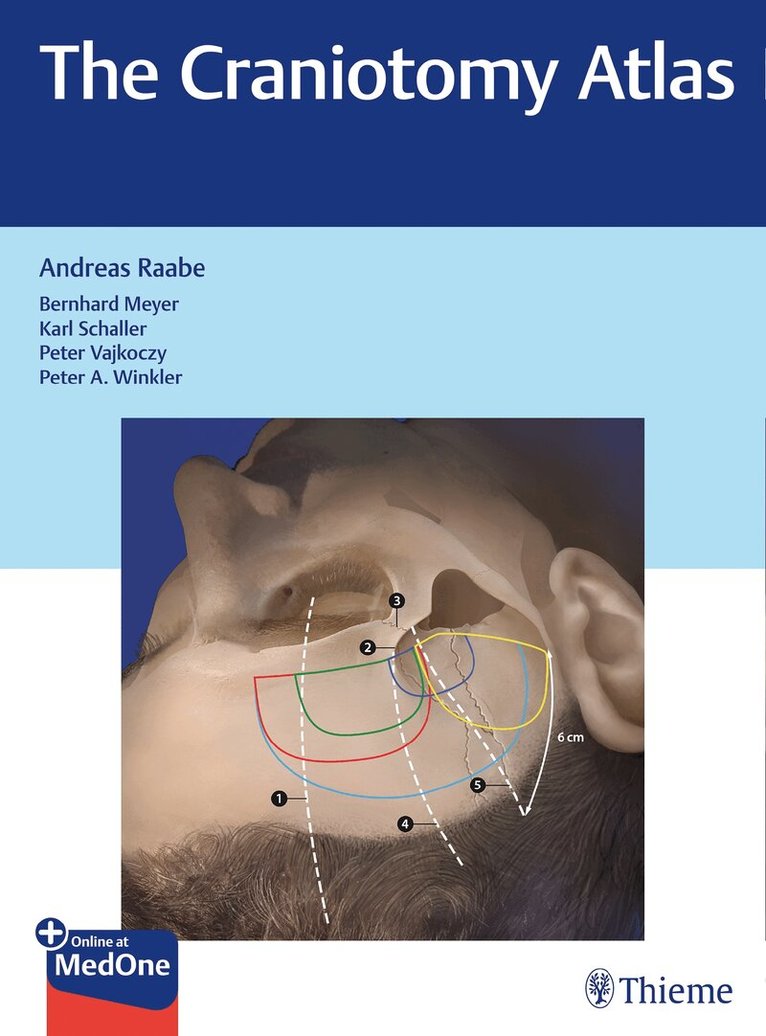 Andreas Raabe - Craniotomy Atlas, Övrigt