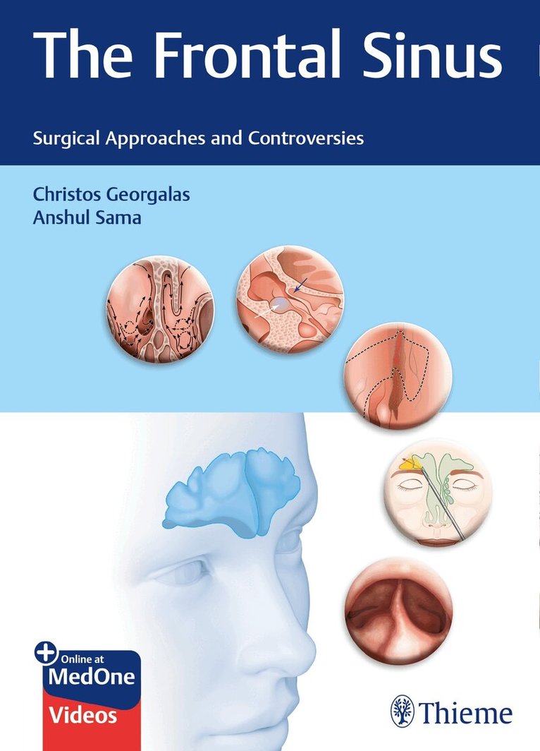 Christos Georgalas, Anshul Sama - Frontal Sinus, Övrigt