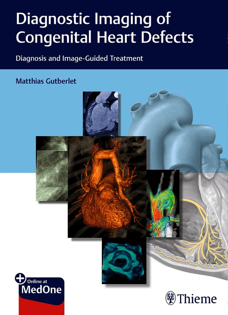 Matthias Gutberlet - Diagnostic Imaging of Congenital Heart Defects, Övrigt