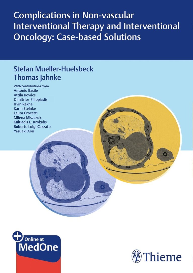 Stefan Müller-Hülsbeck, Thomas Jahnke - Complications in Non-vascular Interventional Therapy and Interventional Oncology: Case-based Solutions. Tillgänglighet: Lägg i varukorg