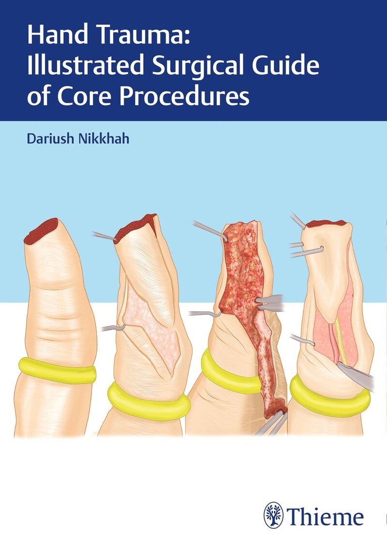 Dariush Nikkhah - Hand Trauma: Illustrated Surgical Guide of Core Procedures, Inbunden. Tillgänglighet: Lägg i varukorg
