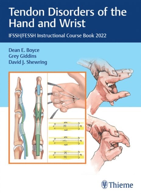 David J. Shewring, Grey Giddins, Dean E. Boyce - Tendon Disorders of the Hand and Wrist, E-bok
