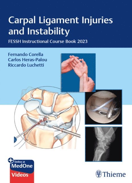 Riccardo Luchetti, Carlos Heras-Palou, Fernando Corella - Carpal Ligament Injuries and Instability, E-bok