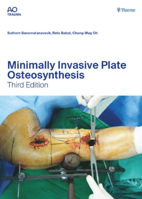 Chang-Wug Oh, Reto Babst, Suthorn Bavonratanavech - Minimally Invasive Plate Osteosynthesis, E-bok