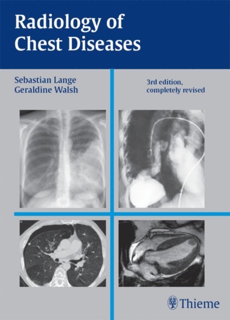 Geraldine Walsh, Sebastian Lange - Radiology of Chest Diseases, E-bok