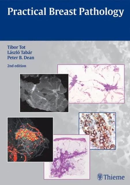 Peter B. Dean, Laszlo Tabar, Tibor Tot - Practical Breast Pathology, E-bok. Tillgänglighet: Lägg i varukorg
