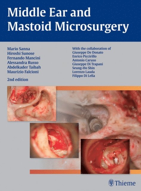 Maurizio Falcioni, Abdelkader Taibah, Alessandra Russo, Fernando Mancini, Hiroshi Sunose, Mario Sanna - Middle Ear and Mastoid Microsurgery, E-bok