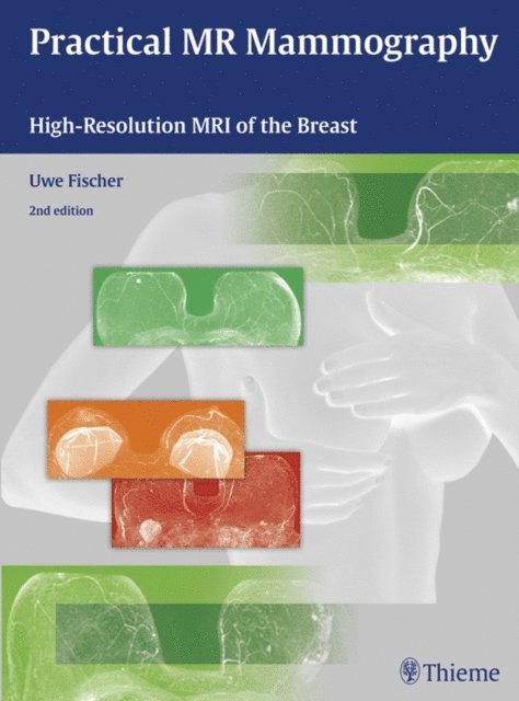 Uwe Fischer - Practical MR Mammography, E-bok